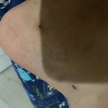 FLO Ayakkabılarının Rahatsız Edici Deneyimi