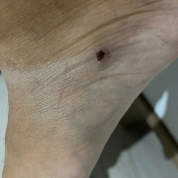 FLO Ayakkabılarının Rahatsız Edici Deneyimi