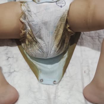 Molfix Bezlerinde Büyük Hayal Kırıklığı