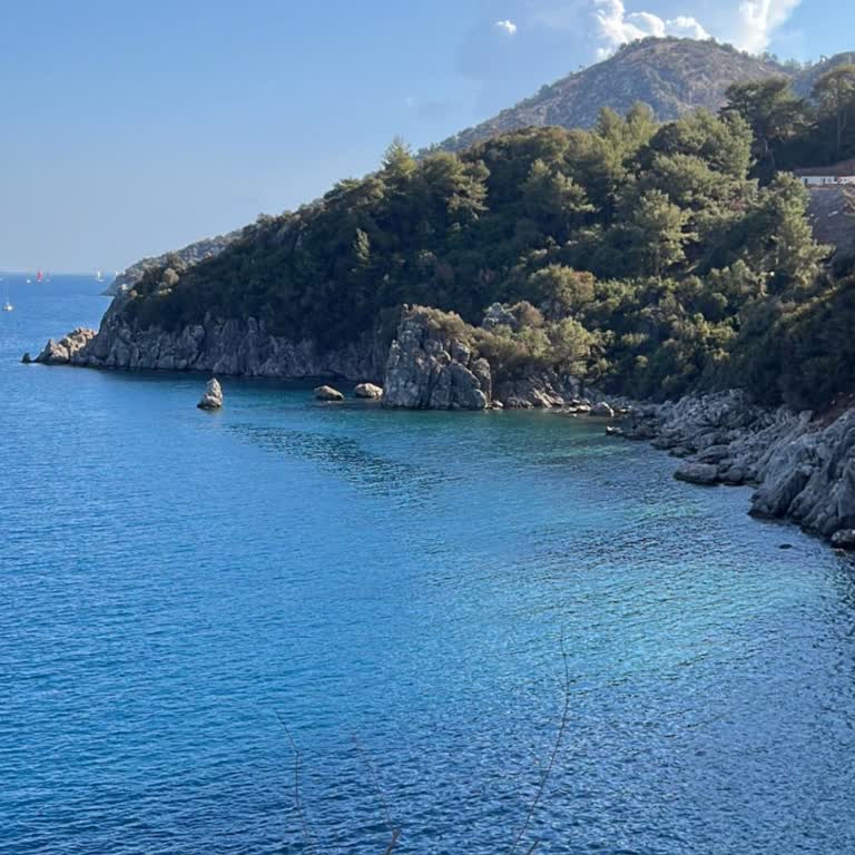 Saç Ekimi Sonrası Beklentilerimin Karşılanmaması