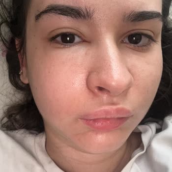 Aşım Dursun Diş Polikliniği Şikayeti