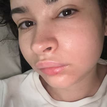 Aşım Dursun Diş Polikliniği Şikayeti