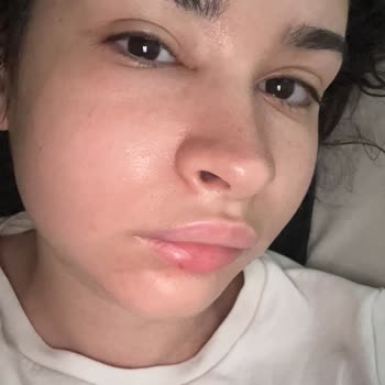 Aşım Dursun Diş Polikliniği Şikayeti