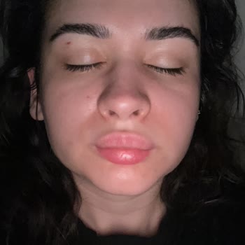 Aşım Dursun Diş Polikliniği Şikayeti