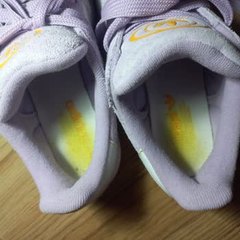 Adidas Ayakkabının Kalite Sorunu Ve İade Süreci