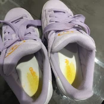 Adidas Ayakkabının Kalite Sorunu Ve İade Süreci