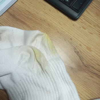 Adidas Ayakkabının Kalite Sorunu Ve İade Süreci