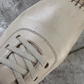 Ayakkabı Bağcığı Sorunu Ve Yetersiz Müşteri Hizmeti