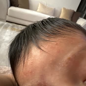Bebeğimin Sağlığı Tehlikede: Mustela Ürünleri Hayal Kırıklığı