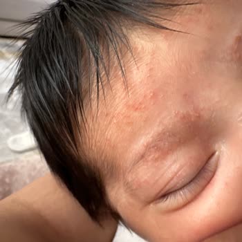 Bebeğimin Sağlığı Tehlikede: Mustela Ürünleri Hayal Kırıklığı