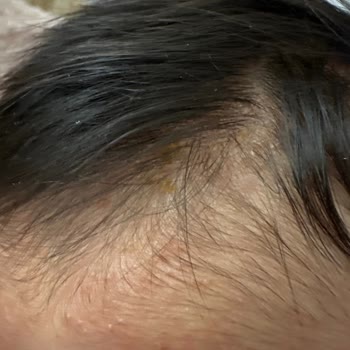 Bebeğimin Sağlığı Tehlikede: Mustela Ürünleri Hayal Kırıklığı