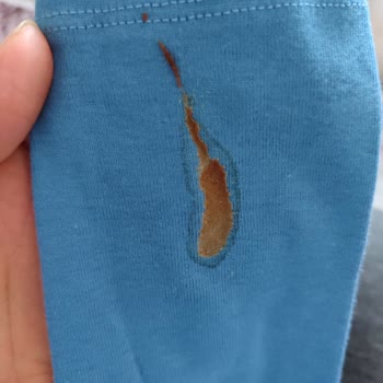 Özensiz Paketleme Ve Hijyen Sorunu