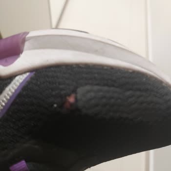 Puma Ayakkabılarımın Yırtılması Ve Müşteri Hizmetleri Hayal Kırıklığı