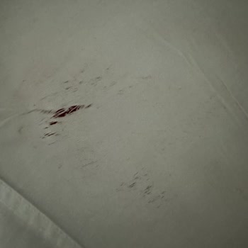 Ütü Arızası Nedeniyle Yanan Gömlek Ve Mağduriyet