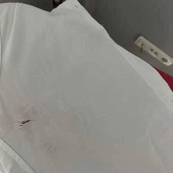 Ütü Arızası Nedeniyle Yanan Gömlek Ve Mağduriyet