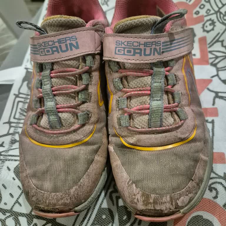 Skechers Ayakkabının Kalitesizliği Ve Firma İlgisizliği