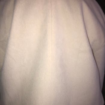 Eksik Düğmeli Kaban Ve İlgisiz Müşteri Hizmetleri