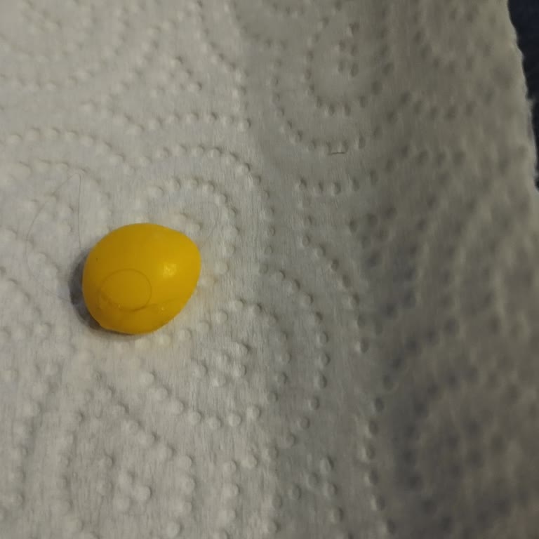 Rocco Şekerin İçinden Çıkan Şok Edici Saç Teli