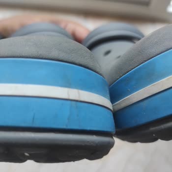 Crocs Terlikte Çatlaklar Ve Kullanıcı Hatası İddiası