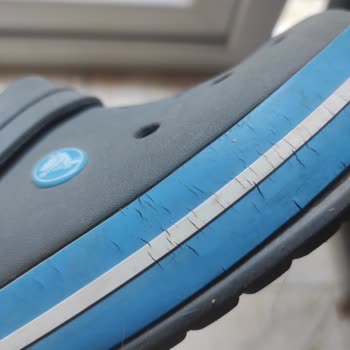 Crocs Terlikte Çatlaklar Ve Kullanıcı Hatası İddiası