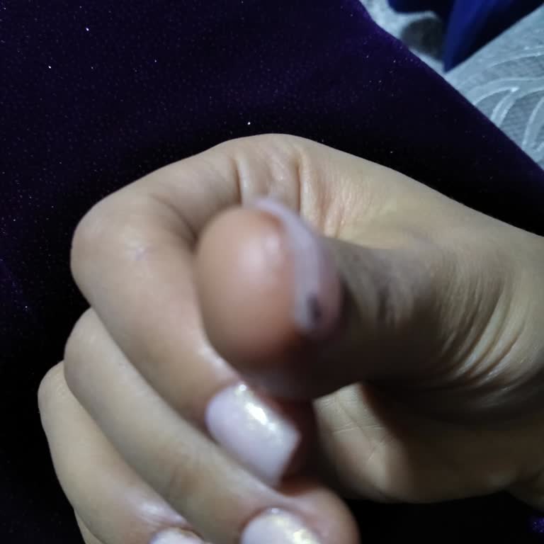 Aymira Koçaklı Yaşam Merkezi'nde Kapsül Tırnak Hizmetine Dair Hayal Kırıklığı