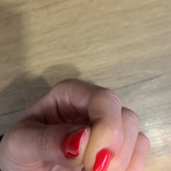 Yanlış Yapılan Protez Tırnaklar Canımı Acıttı