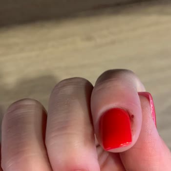 Yanlış Yapılan Protez Tırnaklar Canımı Acıttı