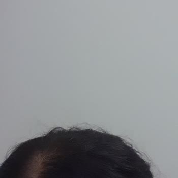 Palette Saç Boyası Renk Uyumsuzluğu Ve Mağduriyet