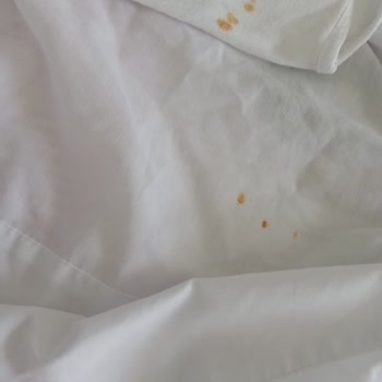 Arçelik Çamaşır Makinesi Pas Lekesi Sorunu Ve Servis Cevapsızlığı