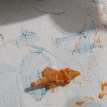 Dönerden Çıkan Kemik Tehlikesi