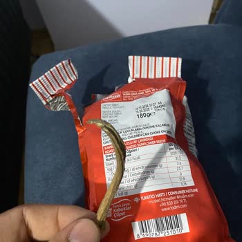 Tadım Çekirdekte Yabancı Cisim Şoku Maç Keyfimi Kaçırdı