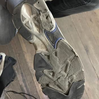 Skechers Ayakkabılarında Beklenmedik Yıpranma: Müşteri Memnuniyetsizliği