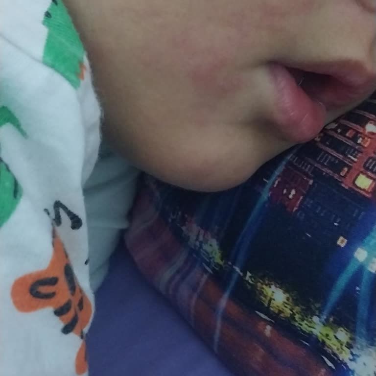 Nutrigen Ürününde Cilt Sorunları Ve Hayal Kırıklığı