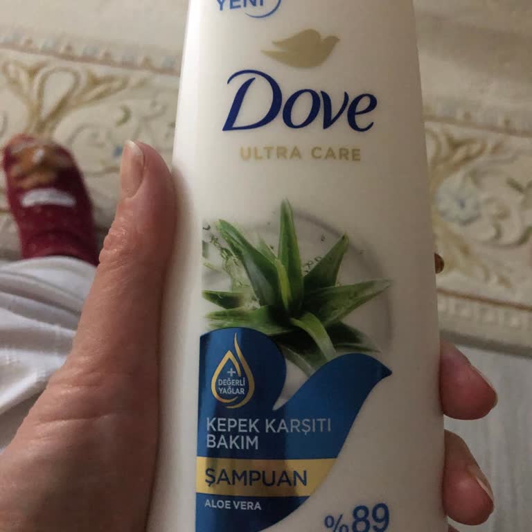 Severe Reaction to Dove Aloe Vera Anti-Dandruff Shampoo – Skin Burn and Discomfort