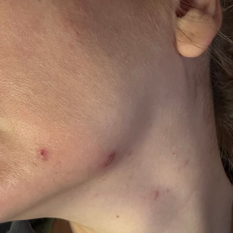 Yanıltıcı Yastık Malzemesi Ve Sağlık Sorunları