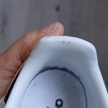 Adidas Ayakkabıda Beklenmedik Soyulma Ve Müşteri Hizmetleri Sorunu