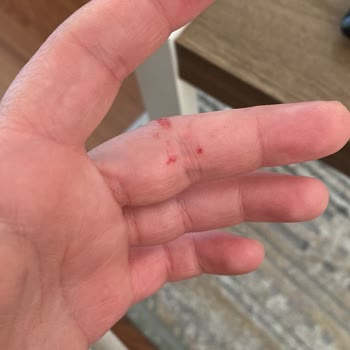 Siemens Buzdolabı Cam Kapağı Tehlikesi