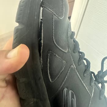 Skechers Ayakkabılarında Tekrarlayan Açılma Sorunu Ve İade Sorunu