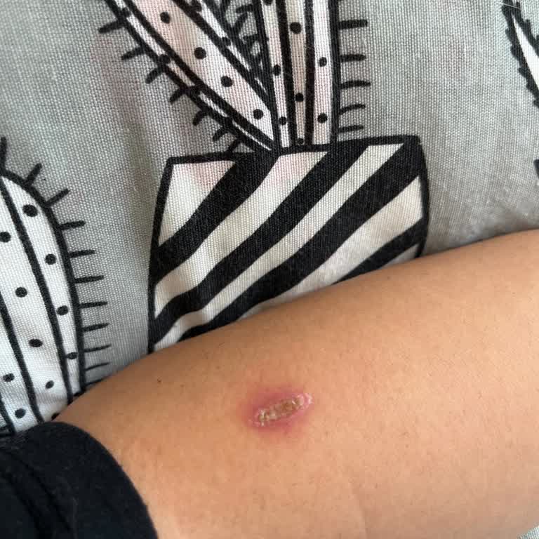 Cihaz Arızaları Ve Yanıklarla Dolan Kötü Deneyim