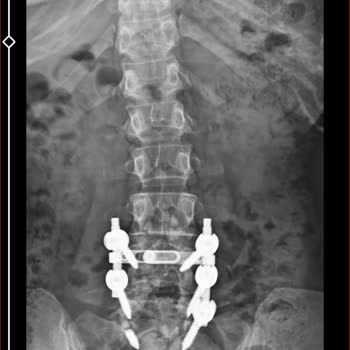Ameliyat Sonrası İlgisizlik Ve Yanlış Bilgilendirme