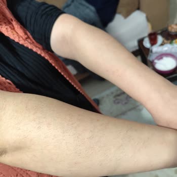 Diod Lazer Tedavisinde Hayal Kırıklığı