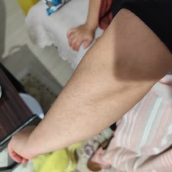 Diod Lazer Tedavisinde Hayal Kırıklığı