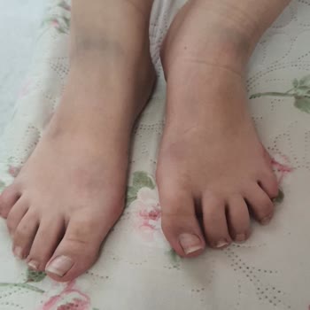 Ayakkabı İade Sürecinde Yaşanan Sorunlar