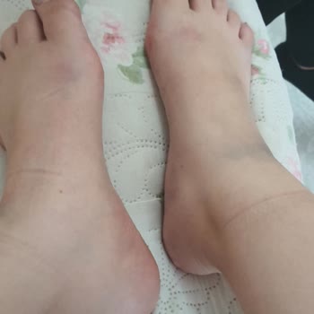 Ayakkabı Sorunu Ve İade Sürecinde Yaşanan Zorluklar