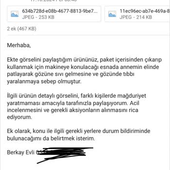 Asperox Sparx'ın Tehlikeli Patlaması Ve İlgisiz Müşteri Hizmetleri