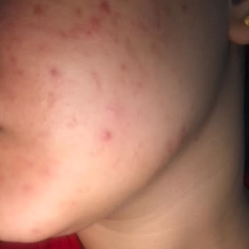 Cosmed Temizlik Ürünleri Cilt Sorunlarını Artırdı