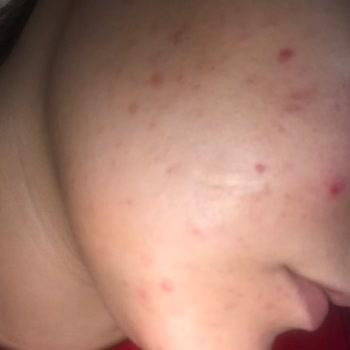 Cosmed Temizlik Ürünleri Cilt Sorunlarını Artırdı