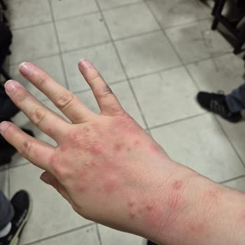 Teşhir Ürünü Yatak Başlığı Kabusu: Tahta Kurusu Sorunu