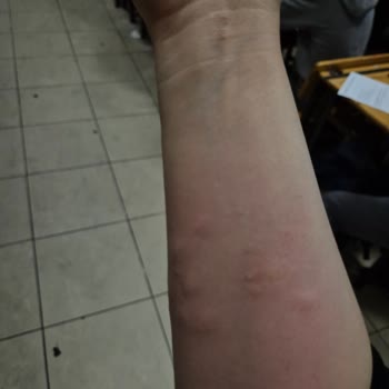 Teşhir Ürünü Yatak Başlığı Kabusu: Tahta Kurusu Sorunu