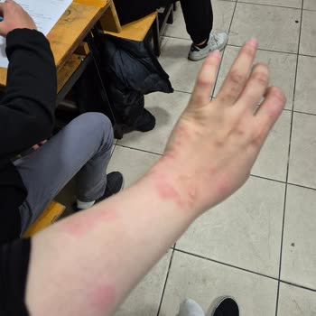 Teşhir Ürünü Yatak Başlığı Kabusu: Tahta Kurusu Sorunu